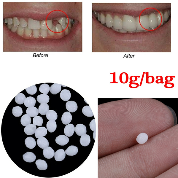 10g Resin FalseTeeth Solid Glue Temporary Tooth Repair Set Teeth And Gap  Falseteeth Solid Glue Denture Adhesive Teeth Dentist